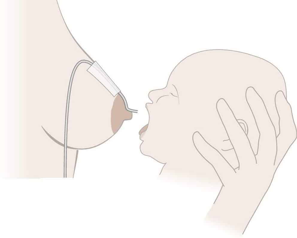 Nuevo Relactador de leche Materna