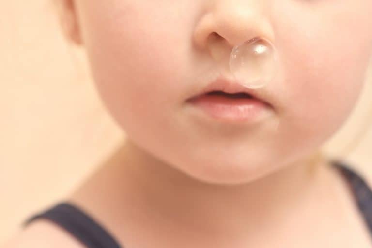 Mocos y flemas en bebés: cómo y cuándo tratarlos, Consultas Frecuentes