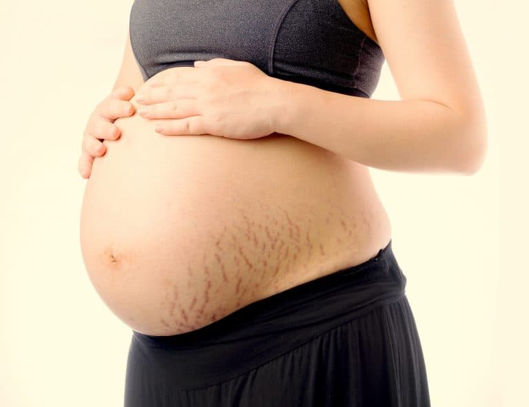 Cuidado de la piel en el embarazo