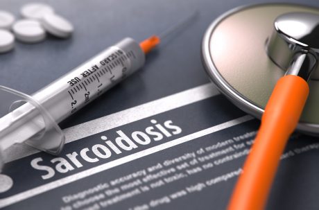 ¿Cómo quitar la sarcoidosis Tratamiento